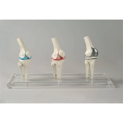 Knee Implant Model – GTSimulators.com