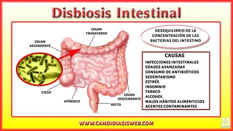 Disbiosis Intestinal Y Su Relaci N Con La Candidiasis