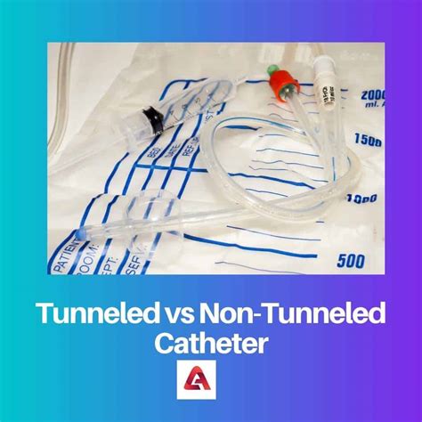 Tunneled Vs Non Tunneled Catheter