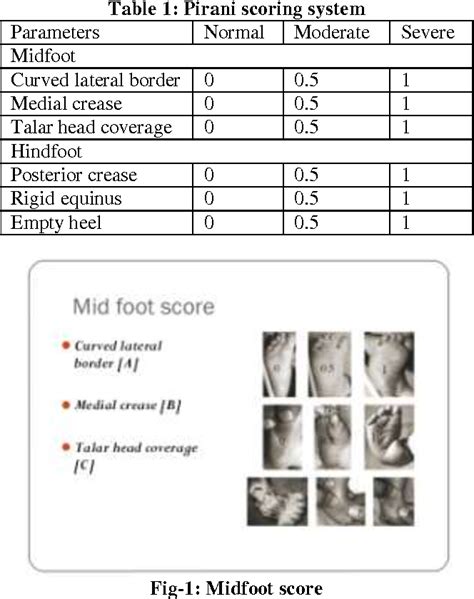 Table 1 From Treatment Of Idiopathic Congenital Talipes Equinovarus