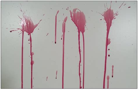 Forensic Blood Spatter Patterns