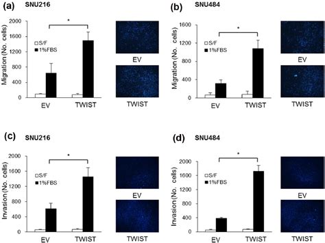 Twist Mediates Resistance To Paclitaxel By Regulating Akt And Bcl 2 Expression In Gastric Cancer