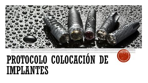 Solution Protocolo Colocaci N De Implantes Y Regeneraci N Sea Guiada