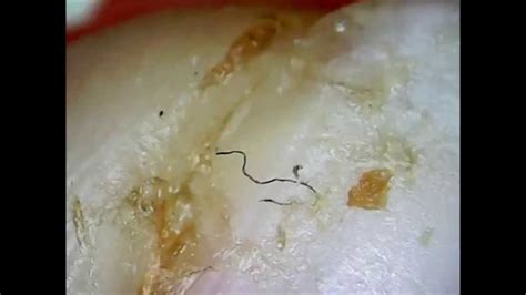 Dirty Fingernails Under a Microscope (Disgusting !!) - YouTube