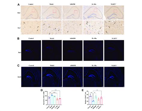 Microglia Activation Iba And Nerve Regeneration Brdu In The