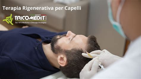 Rivoluzione Contro La Calvizie Scopri La Terapia Rigenerativa Per