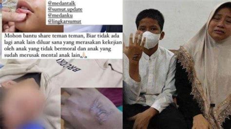 Polisi Buru Tiga Pelaku Perundungan Siswa MAN 1 Medan Korban Alami