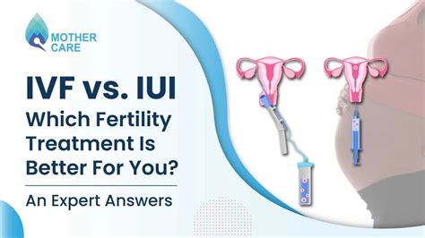 IVF Vs IUI Which Fertility Treatment Is Better For You