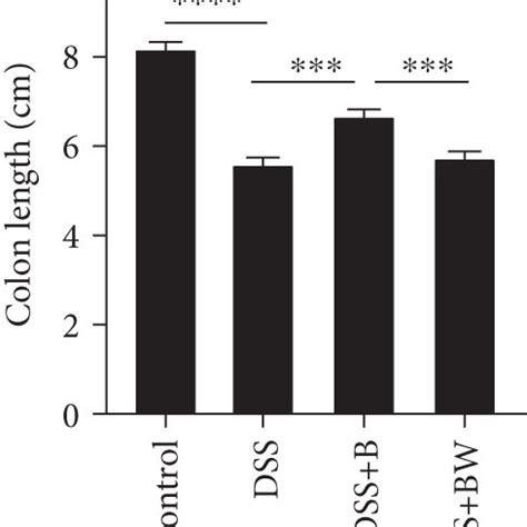 Effect Of Wogonin On B Cells In Mouse With Acute Colitis Induced By