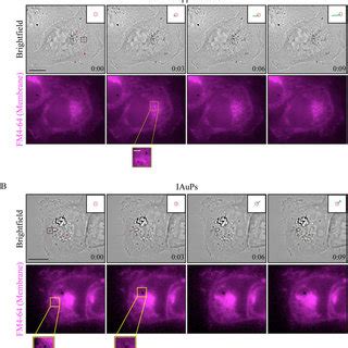 A Brightfield And Fluorescence Images Of Hff And Hela Cells