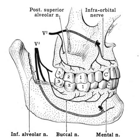 Buccal Nerve Block Wikem