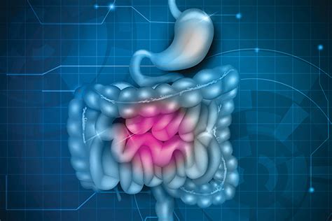 Comment dépister et traiter efficacement le cancer du colon