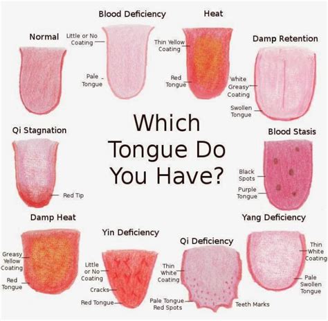 Why Do I Have Black Spots On My Tongue Guidancematerial