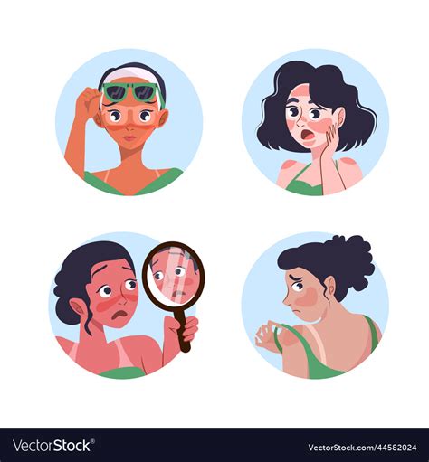 Sunburn Cartoon Girl