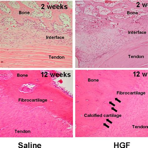 The scores for the tendon-bone healing process based on... | Download ...