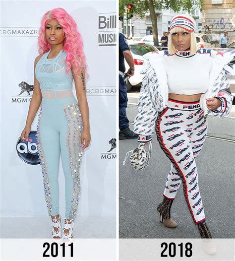 Nicki Minaj Says She Regrets Plastic Surgery After Seeing Older Photos ...