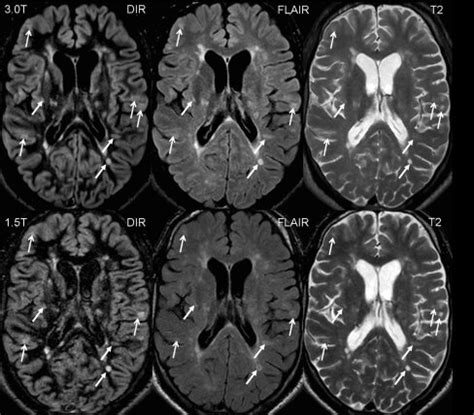 Transverse Sections Of The Supratentorial Brain Of A 31 Year Old Man