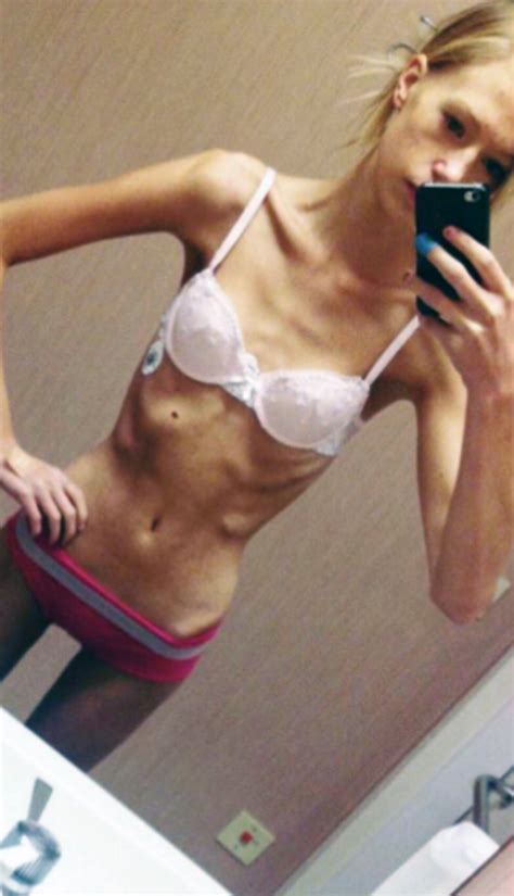 Pictures Showing For Anorexic Belly Bulge Porn Mypornarchive Net