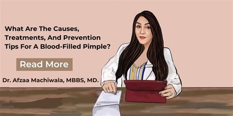 What Are The Causes, Treatments, And Prevention Tips For A Blood-Filled Pimple?