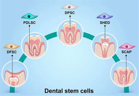 Human Dental Mesenchymal Stem Cells Dscs Can Be Isolated From Pulp