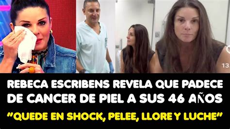 Rebeca Escribens Revela Que Padece De Cancer De Piel A Sus A Os