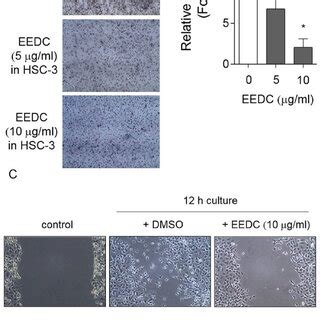 Eedc Inhibits Invasion Of Hsc Cells A Cytotoxicity Of Eedc To Ngf