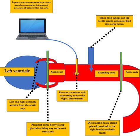 Diagram of the aortic root and ascending aorta pressure apparatus. This ...