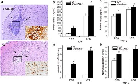 Figures and data in FAM76B regulates NF κB mediated inflammatory