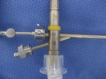 Performance of Rigid Bronchoscopy | Anesthesia Key