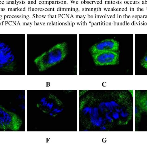 The Subcellular Localization Of Pcna Proteins At The Stage Of Division