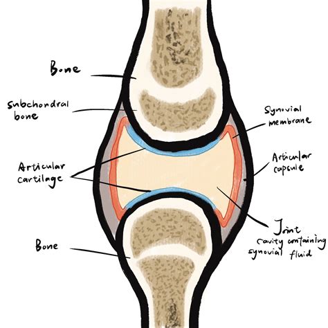 Degenerative Joint Disease — The Sword In The Bone