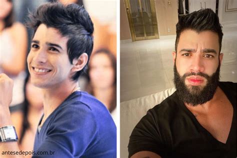 Gusttavo Lima Antes E Depois Em Fotos Que Chocam