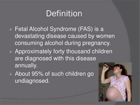 Ppt Fetal Alcohol Syndrome Powerpoint Presentation Free Download Id 4825811