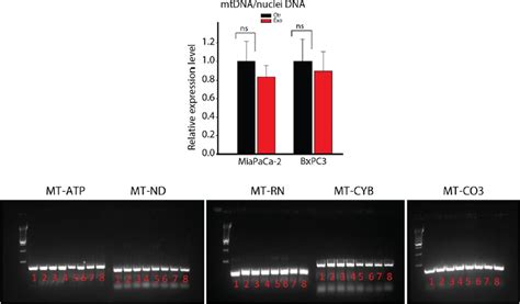 Figures And Data In Tumor Microenvironment Derived Exosomes