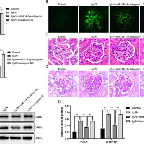 MiR 214 3p Is Involved In Mesangial Cell Proliferation By Targeting