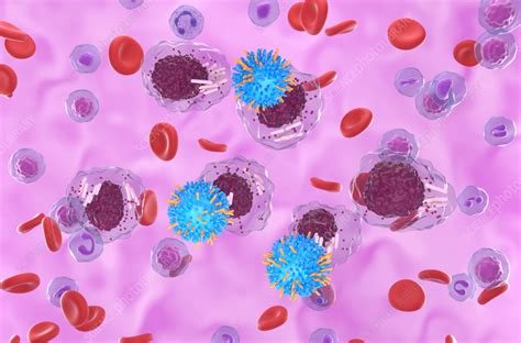 Car T Cell Therapy For Chronic Lymphoblastic Leukaemia Illustration