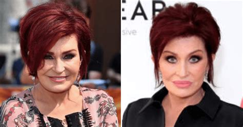 Sharon Osbourne Swears Off Cosmetic Surgery After FIFTH Facelift Leaves