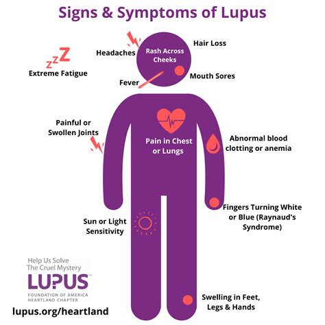 Raise Awareness of Lupus | Heartland | Lupus Foundation of America