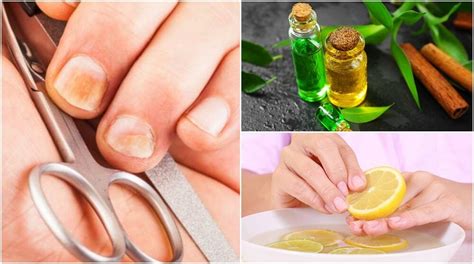 5 Trucos Caseros Y Fáciles Para Eliminar Hongos Y Fortalecer Las Uñas Mejor Con Salud