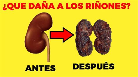 10 Hábitos que dañan tus riñones y las señales de que están enfermos