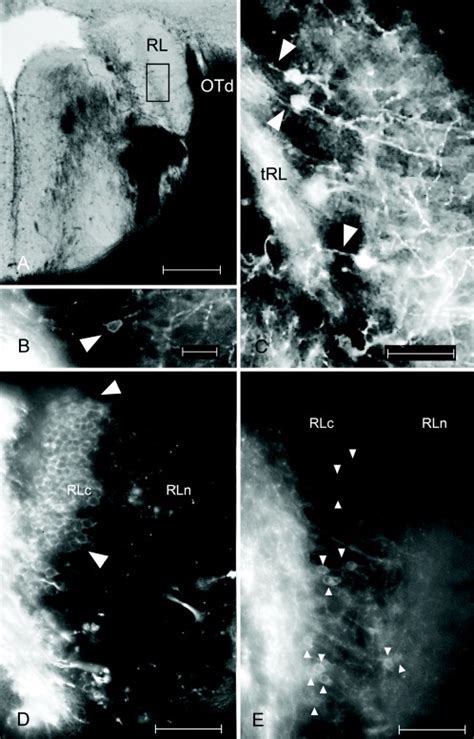 Neuron Labeling In Rl After Dii Applied To Ip A A Dii Labeled Rl Is