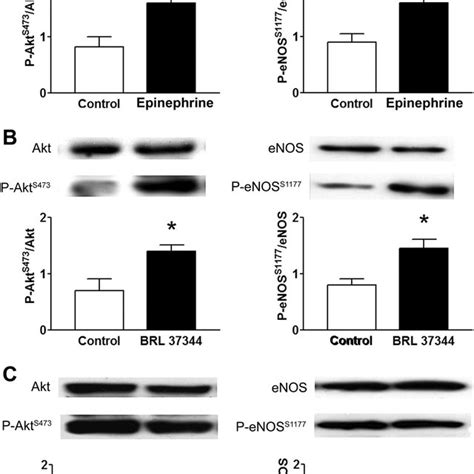 Epinephrine Induced Endothelial Nos Enos Phosphorylation By The