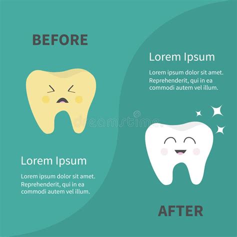 Antes Después De Icono Sonriente Sano Del Diente De Infographic Estrella De Sining Malos Dientes