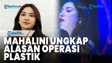 Wajah Berubah Drastis Mahalini Ungkap Alasan Jalani Operasi Plastik