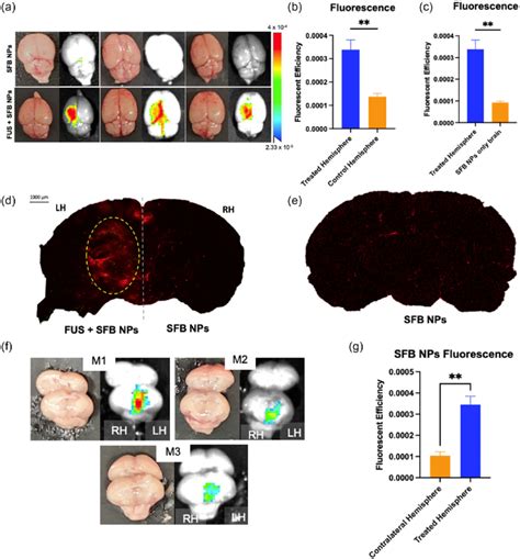 Fus Mediated Bbb Disruption Improves Sfb Nps Penetration Into The