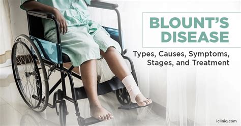 What Is Blount’s Disease?