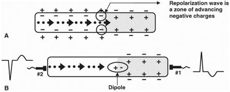 Depolarization Anatomy Definition Anatomy Drawing Diagram