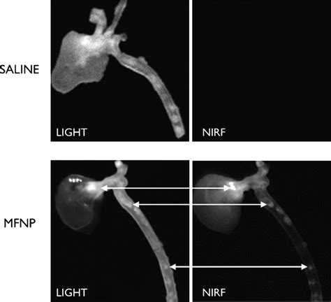 Ex Vivo Macroscopic Light Left And Near Infrared Fluorescence Nirf