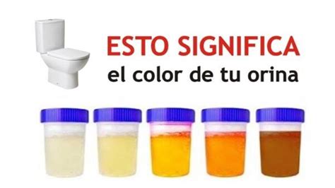 Color De La Orina Amo Mi Salud