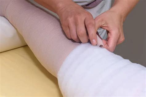 Woman Bandaging Patient S Legs Stock Photo Vpardi 113158588